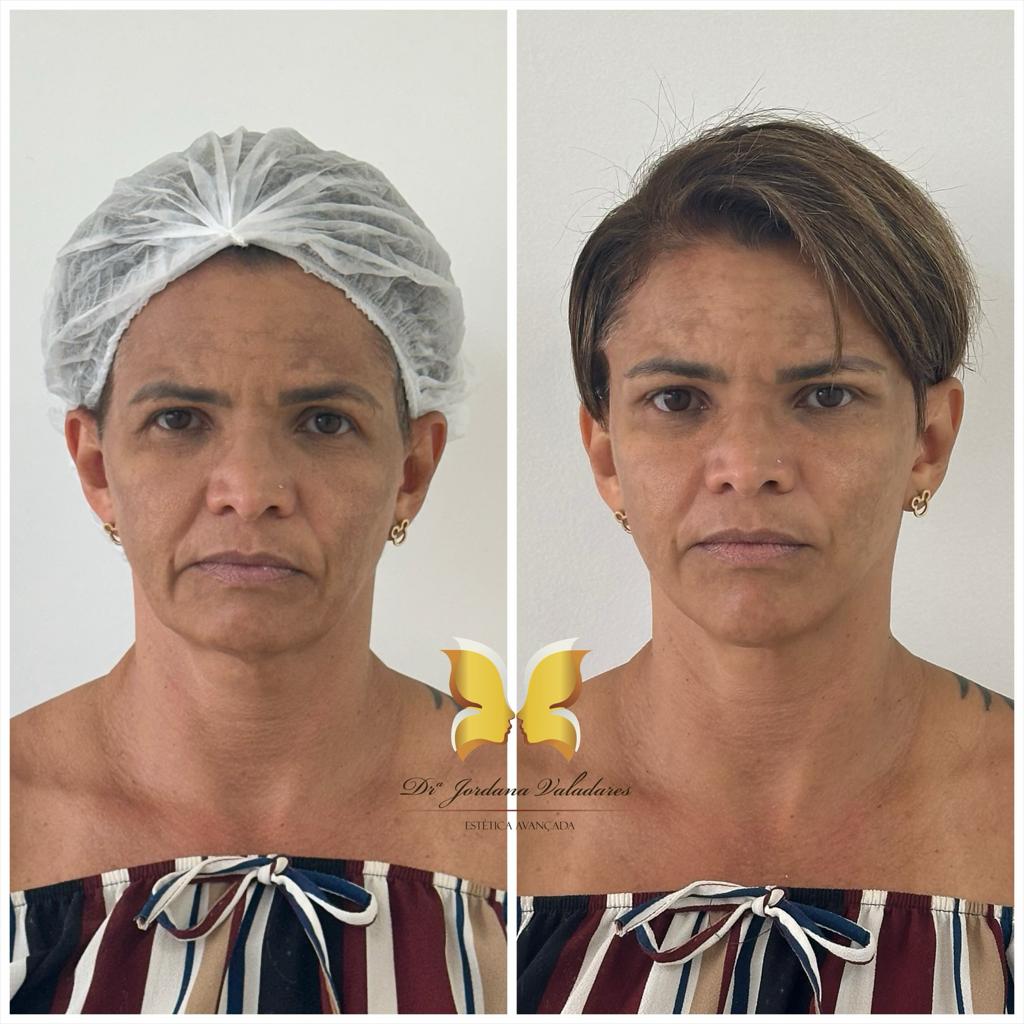 Paciente com antes e depois