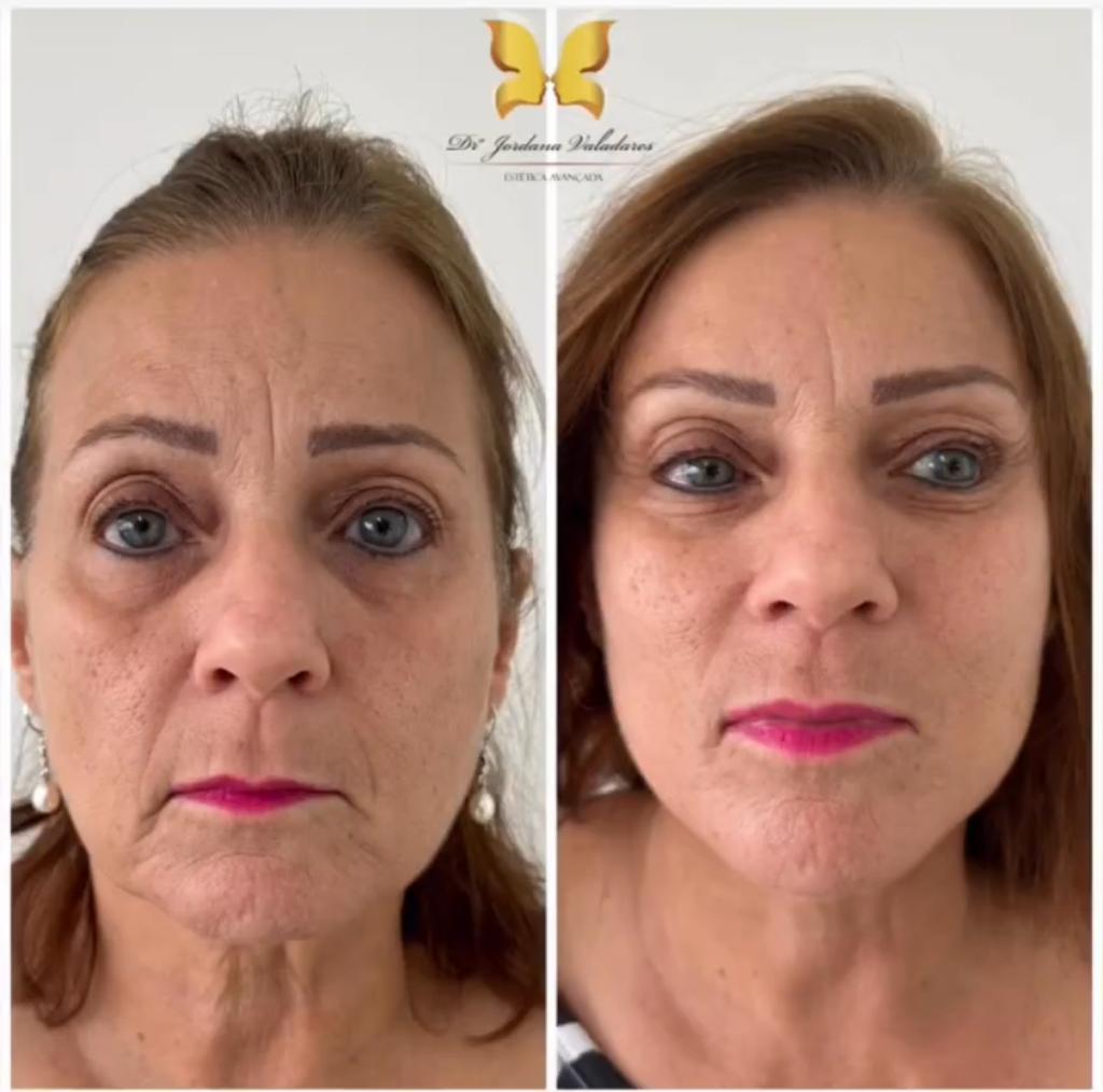 Paciente com antes e depois