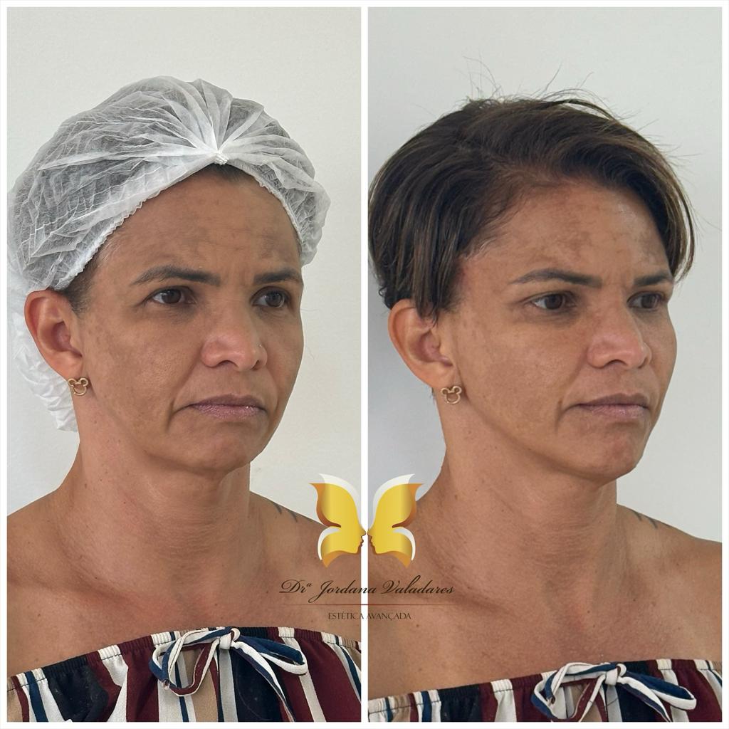 Paciente com antes e depois