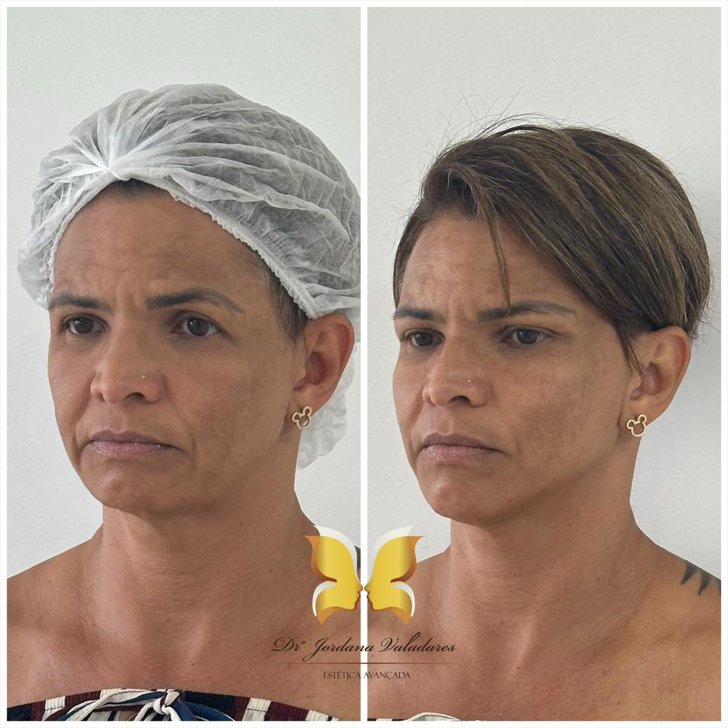 Paciente com antes e depois