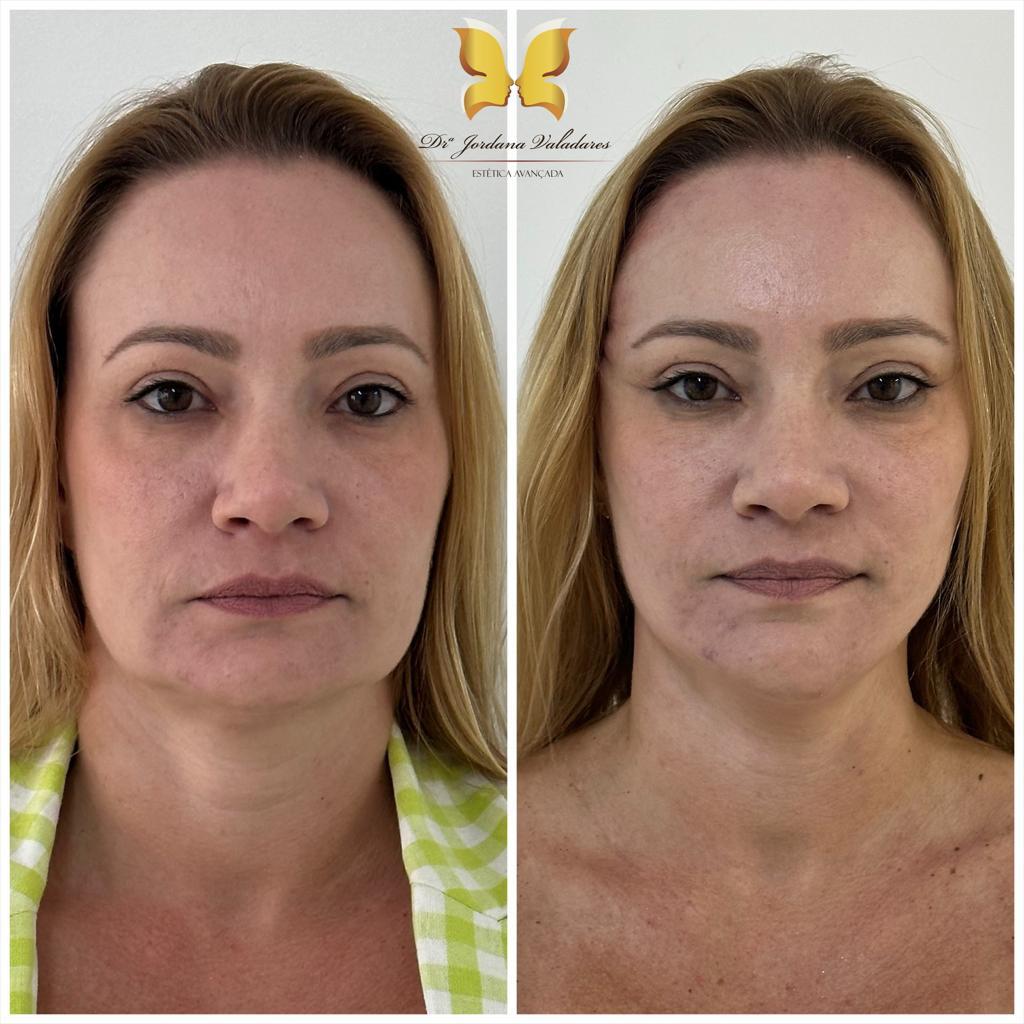 Paciente com antes e depois