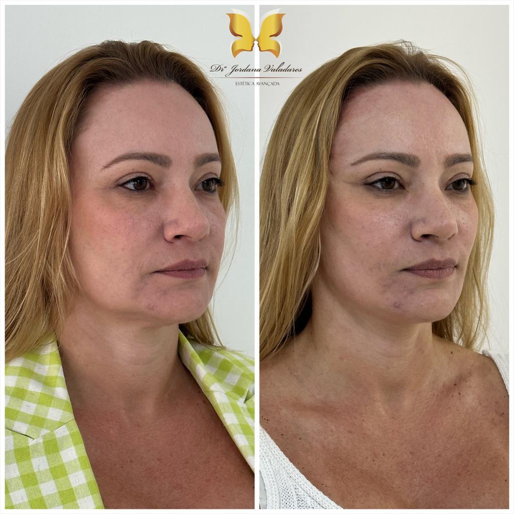 Paciente com antes e depois