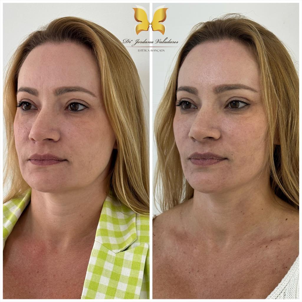 Paciente com antes e depois