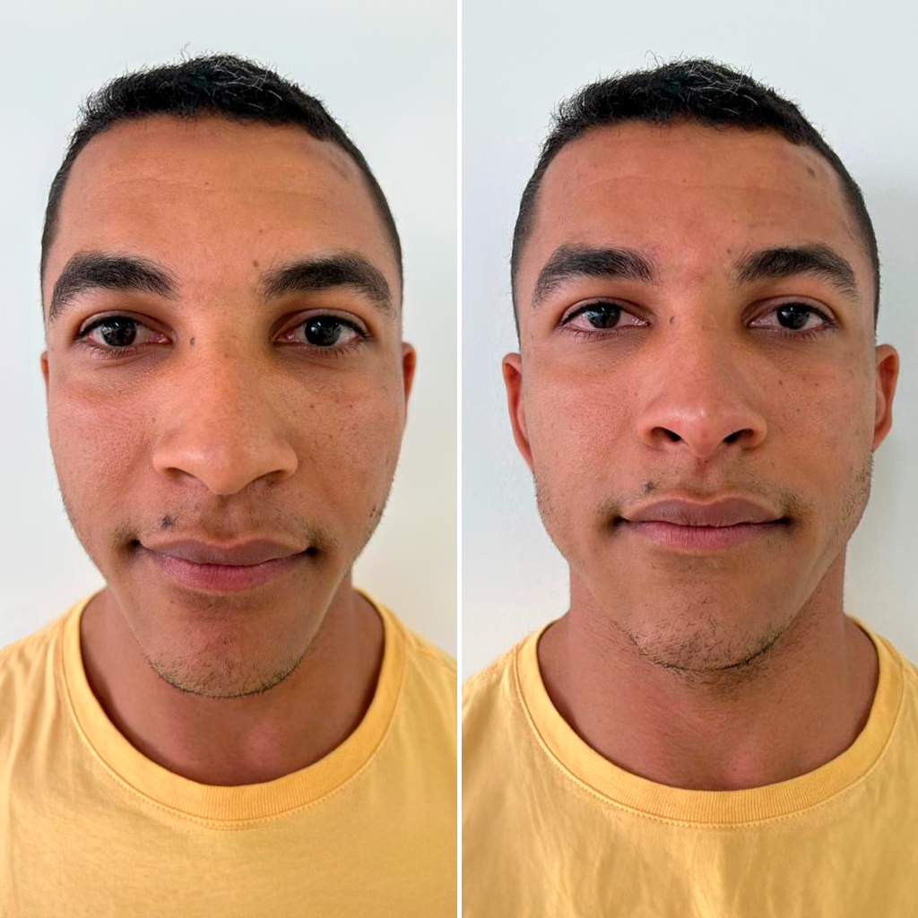 Paciente com antes e depois